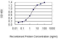 E2F3 Antibody - Detection limit for recombinant GST tagged E2F3 is 0.03 ng/ml as a capture antibody.