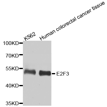 E2F3 Antibody - Western blot analysis of extracts of various cell lines.