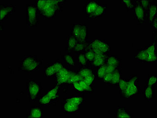 E2F3 Antibody - Immunofluorescent analysis of HepG2 cells using E2F3 Antibody at a dilution of 1:100 and Alexa Fluor 488-congugated AffiniPure Goat Anti-Rabbit IgG(H+L)