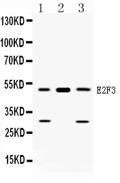 E2F3 Antibody - Western blot analysis of E2F3 expression in rat liver extract (lane 1), mouse cardiac muscle extract (lane 2) and U2OS whole cell lysates (lane 3). E2F3 at 49KD was detected using rabbit anti-E2F3 Antigen Affinity purified polyclonal antibody at 0.5 µg/mL. The blot was developed using chemiluminescence (ECL) method.