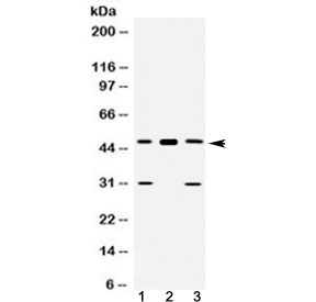 E2F3 Antibody - Western blot testing of 1) rat liver, 2) mouse heart and 3) human U-2 OS lysate with E2F3 antibody at 0.5ug/ml. Predicted molecular weight ~49 kDa.