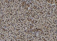 E2F3 Antibody - 1:100 staining mouse kidney tissue by IHC-P. The sample was formaldehyde fixed and a heat mediated antigen retrieval step in citrate buffer was performed. The sample was then blocked and incubated with the antibody for 1.5 hours at 22°C. An HRP conjugated goat anti-rabbit antibody was used as the secondary.