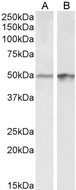 E2F4 Antibody - E2F4 antibody (0.3 ug/ml) staining of A43 (A) and HeLa (B) lysates (35 ug protein in RIPA buffer). Primary incubation was 1 hour. Detected by chemiluminescence.