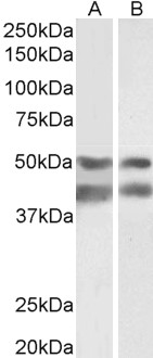 E2F4 Antibody - Goat Anti-Transcription factor E2F4 Antibody (0.003µg/ml) staining of Pig Brain (A) and Heart (B) lysates (35µg protein in RIPA buffer). Primary incubation was 1 hour. Detected by chemiluminescencence