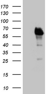E2F4 Antibody - HEK293T cells were transfected with the pCMV6-ENTRY control. (Left lane) or pCMV6-ENTRY E2F4. (Right lane) cDNA for 48 hrs and lysed. Equivalent amounts of cell lysates. (5 ug per lane) were separated by SDS-PAGE and immunoblotted with anti-E2F4. (1:500)
