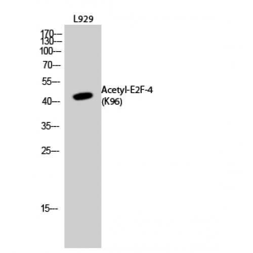 E2F4 Antibody - Western blot of Acetyl-E2F-4 (K96) antibody