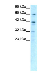 E2F4 Antibody - E2F4 antibody Western blot of HepG2 cell lysate. This image was taken for the unconjugated form of this product. Other forms have not been tested.
