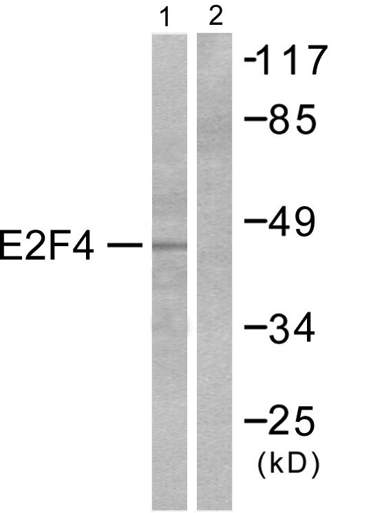 E2F4 Antibody - Western blot analysis of lysates from COS7 cells, using E2F4 Antibody. The lane on the right is blocked with the synthesized peptide.
