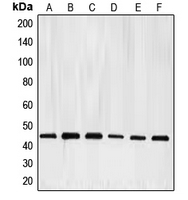 E2F4 Antibody - Western blot analysis of E2F4 expression in HeLa (A); K562 (B); Jurkat (C); Raji (D); A431 (E); mouse kidney (F) whole cell lysates.