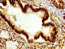 E2F4 Antibody - Immunohistochemistry image of paraffin-embedded human lung tissue at a dilution of 1:100