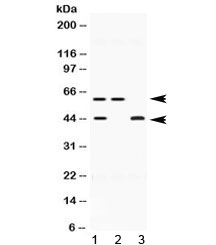 E2F4 Antibody - Western blot testing of human 1) HeLa, 2) U-2 OS and 3) MCF7 lysate with E2F4 antibody at 0.5ug/ml. Expected molecular weight ~44 kDa (unmodified) and 60-65 kDa (phosphorylated).