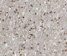 E2F4 Antibody - 1:100 staining human brain tissue by IHC-P. The tissue was formaldehyde fixed and a heat mediated antigen retrieval step in citrate buffer was performed. The tissue was then blocked and incubated with the antibody for 1.5 hours at 22°C. An HRP conjugated goat anti-rabbit antibody was used as the secondary.