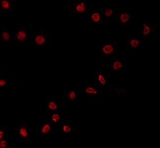 E2F4 Antibody - Staining COS7 cells by IF/ICC. The samples were fixed with PFA and permeabilized in 0.1% Triton X-100, then blocked in 10% serum for 45 min at 25°C. The primary antibody was diluted at 1:200 and incubated with the sample for 1 hour at 37°C. An Alexa Fluor 594 conjugated goat anti-rabbit IgG (H+L) Ab, diluted at 1/600, was used as the secondary antibody.