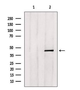 E2F4 Antibody - Western blot analysis of extracts of HepG2 cells using E2F4 antibody. Lane 1 was treated with the blocking peptide.