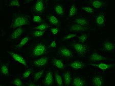 E2F4 Antibody - Immunofluorescence staining of E2F4 in HeLa cells. Cells were fixed with 4% PFA, permeabilzed with 0.1% Triton X-100 in PBS, blocked with 10% serum, and incubated with rabbit anti-Human E2F4 polyclonal antibody (dilution ratio 1:200) at 4°C overnight. Then cells were stained with the Alexa Fluor 488-conjugated Goat Anti-rabbit IgG secondary antibody (green). Positive staining was localized to Nucleus.