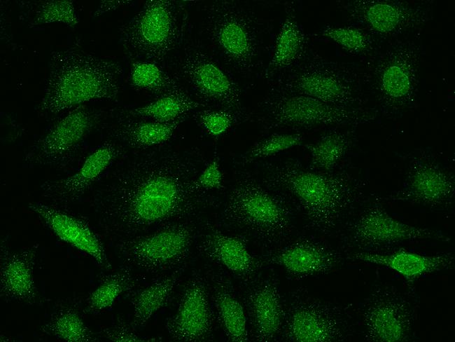 E2F4 Antibody - Immunofluorescence staining of E2F4 in HeLa cells. Cells were fixed with 4% PFA, permeabilzed with 0.1% Triton X-100 in PBS, blocked with 10% serum, and incubated with rabbit anti-Human E2F4 polyclonal antibody (dilution ratio 1:200) at 4°C overnight. Then cells were stained with the Alexa Fluor 488-conjugated Goat Anti-rabbit IgG secondary antibody (green). Positive staining was localized to Nucleus.