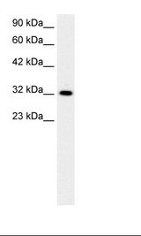 E2F5 Antibody - Jurkat Cell Lysate.  This image was taken for the unconjugated form of this product. Other forms have not been tested.