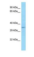 E2F5 Antibody - E2F5 antibody Western Blot of Mouse Pancreas . Antibody dilution: 1 ug/ml.  This image was taken for the unconjugated form of this product. Other forms have not been tested.