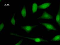 E2F5 Antibody - Immunostaining analysis in HeLa cells. HeLa cells were fixed with 4% paraformaldehyde and permeabilized with 0.1% Triton X-100 in PBS. The cells were immunostained with anti-E2F5 mAb.