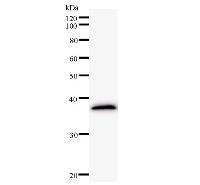E2F5 Antibody - Western blot analysis of immunized recombinant protein, using anti-E2F5 monoclonal antibody.