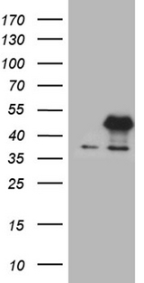 E2F5 Antibody - HEK293T cells were transfected with the pCMV6-ENTRY control. (Left lane) or pCMV6-ENTRY E2F5. (Right lane) cDNA for 48 hrs and lysed. Equivalent amounts of cell lysates. (5 ug per lane) were separated by SDS-PAGE and immunoblotted with anti-E2F5. (1:2000)