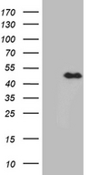 E2F5 Antibody - HEK293T cells were transfected with the pCMV6-ENTRY control. (Left lane) or pCMV6-ENTRY E2F5. (Right lane) cDNA for 48 hrs and lysed. Equivalent amounts of cell lysates. (5 ug per lane) were separated by SDS-PAGE and immunoblotted with anti-E2F5. (1:2000)