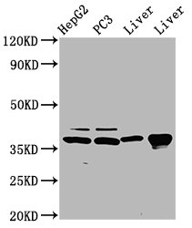 E2F5 Antibody - Western Blot Positive WB detected in: HepG2 whole cell lysate, PC3 whole cell lysate, Rat liver tissue, Mouse liver tissue All Lanes: E2F5 antibody at 5µg/ml Secondary Goat polyclonal to rabbit IgG at 1/50000 dilution Predicted band size: 38, 21 KDa Observed band size: 38 KDa