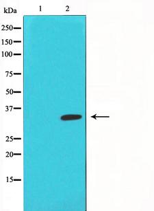 E2F5 Antibody - Western blot analysis of E2F5 expression in HeLa cells. The lane on the left is treated with the antigen-specific peptide.
