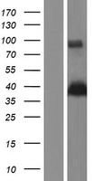 E2F5 Protein - Western validation with an anti-DDK antibody * L: Control HEK293 lysate R: Over-expression lysate