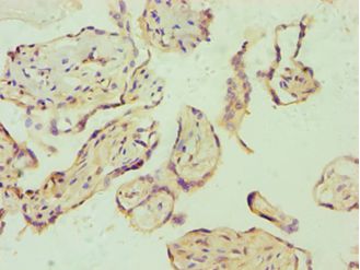 E2F6 Antibody - Immunohistochemistry of paraffin-embedded human placenta using antibody at 1:100 dilution.