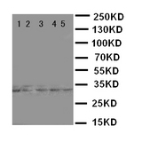 E2F6 Antibody - WB of E2F6 antibody. Lane 1: HELA Cell Lysate. Lane 2: COLO320 Cell Lysate. Lane 3: A549 Cell Lysate. Lane 4: MCF-7 Cell Lysate. Lane 5: SMMC Cell Lysate..