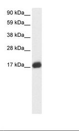 E2F6 Antibody - Placenta Lysate.  This image was taken for the unconjugated form of this product. Other forms have not been tested.