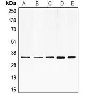 E2F6 Antibody - Western blot analysis of E2F6 expression in HeLa (A); HepG2 (B); K562 (C); mouse muscle (D); rat heart (E) whole cell lysates.