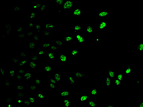 E2F6 Antibody - Immunofluorescence analysis of HeLa cell using E2F6 antibody.