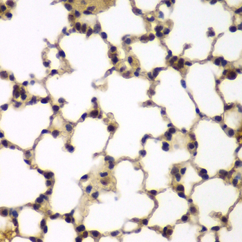 E2F6 Antibody - Immunohistochemistry of paraffin-embedded mouse lung tissue.