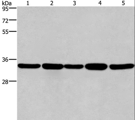 E2F6 Antibody - Western blot analysis of LoVo and A549 cell, human hepatocellular carcinoma tissue, Jurkat and HeLa cell, using E2F6 Polyclonal Antibody at dilution of 1:650.