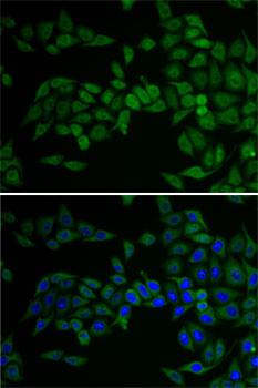 E2F6 Antibody - Immunofluorescence analysis of U2OS cells using E2F6 antibody. Blue: DAPI for nuclear staining.