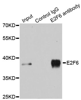 E2F6 Antibody - Immunoprecipitation analysis of 200ug extracts of MCF-7 cells using 3ug E2F6 antibody. Western blot was performed from the immunoprecipitate using E2F6 antibody at a dilition of 1:500.