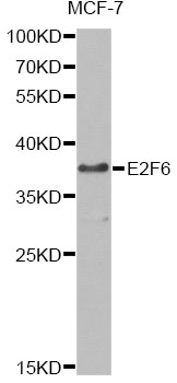 E2F6 Antibody - Western blot analysis of extracts of MCF-7 cells, using E2F6 antibody at 1:1000 dilution. The secondary antibody used was an HRP Goat Anti-Rabbit IgG (H+L) at 1:10000 dilution. Lysates were loaded 25ug per lane and 3% nonfat dry milk in TBST was used for blocking. An ECL Kit was used for detection and the exposure time was 90s.