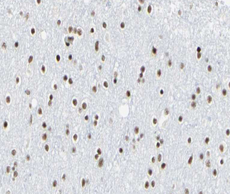 E2F6 Antibody - 1:100 staining human brain tissue by IHC-P. The tissue was formaldehyde fixed and a heat mediated antigen retrieval step in citrate buffer was performed. The tissue was then blocked and incubated with the antibody for 1.5 hours at 22°C. An HRP conjugated goat anti-rabbit antibody was used as the secondary.