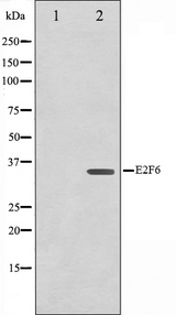 E2F6 Antibody - Western blot analysis on HepG2 cell lysates using E2F6 antibody. The lane on the left is treated with the antigen-specific peptide.