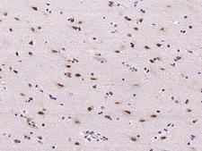 E2F6 Antibody - Immunochemical staining of human E2F6 in human brain with rabbit polyclonal antibody at 1:300 dilution, formalin-fixed paraffin embedded sections.