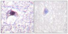 E2F6 Antibody - Peptide - + Immunohistochemical analysis of paraffin-embedded human brain tissue using E2F6 antibody.