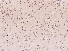 E2F6 Antibody - Immunochemical staining of mouse E2F6 in mouse brain with rabbit polyclonal antibody at 1:1000 dilution, formalin-fixed paraffin embedded sections.