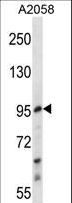 E2F7 Antibody - E2F7 Antibody western blot of A2058 cell line lysates (35 ug/lane). The E2F7 antibody detected the E2F7 protein (arrow).