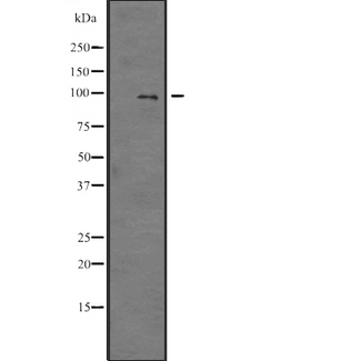 E2F7 Antibody - Western blot analysis of E2F7 expression in SP2/0 cells lysate. The lane on the left is treated with the antigen-specific peptide.