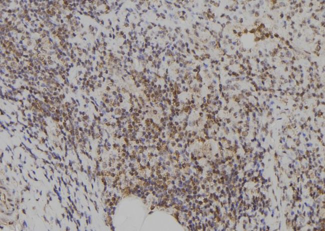 E2F7 Antibody - 1:100 staining human spleen tissue by IHC-P. The sample was formaldehyde fixed and a heat mediated antigen retrieval step in citrate buffer was performed. The sample was then blocked and incubated with the antibody for 1.5 hours at 22°C. An HRP conjugated goat anti-rabbit antibody was used as the secondary.