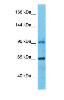 E2F8 Antibody - Western blot of E2F8 Antibody with human RPMI-8226 Whole Cell lysate.  This image was taken for the unconjugated form of this product. Other forms have not been tested.