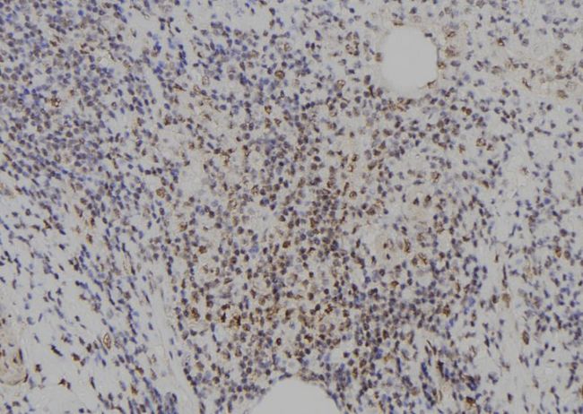 E2F8 Antibody - 1:100 staining human spleen tissue by IHC-P. The sample was formaldehyde fixed and a heat mediated antigen retrieval step in citrate buffer was performed. The sample was then blocked and incubated with the antibody for 1.5 hours at 22°C. An HRP conjugated goat anti-rabbit antibody was used as the secondary.