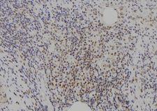 E2F8 Antibody - 1:100 staining human spleen tissue by IHC-P. The sample was formaldehyde fixed and a heat mediated antigen retrieval step in citrate buffer was performed. The sample was then blocked and incubated with the antibody for 1.5 hours at 22°C. An HRP conjugated goat anti-rabbit antibody was used as the secondary.